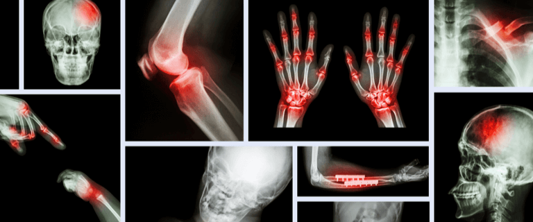 医療オブジェクトの分類